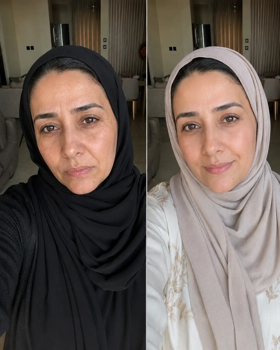 تجربة سارة العتيبي مع علكات التجاعيد