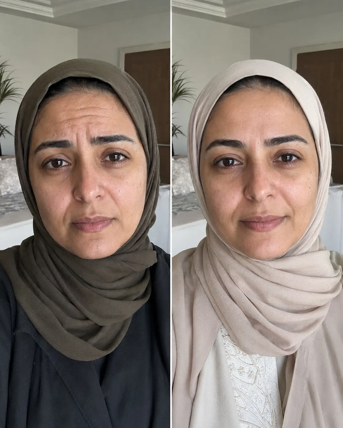 تجربة نورة الدوسري مع علكات التجاعيد