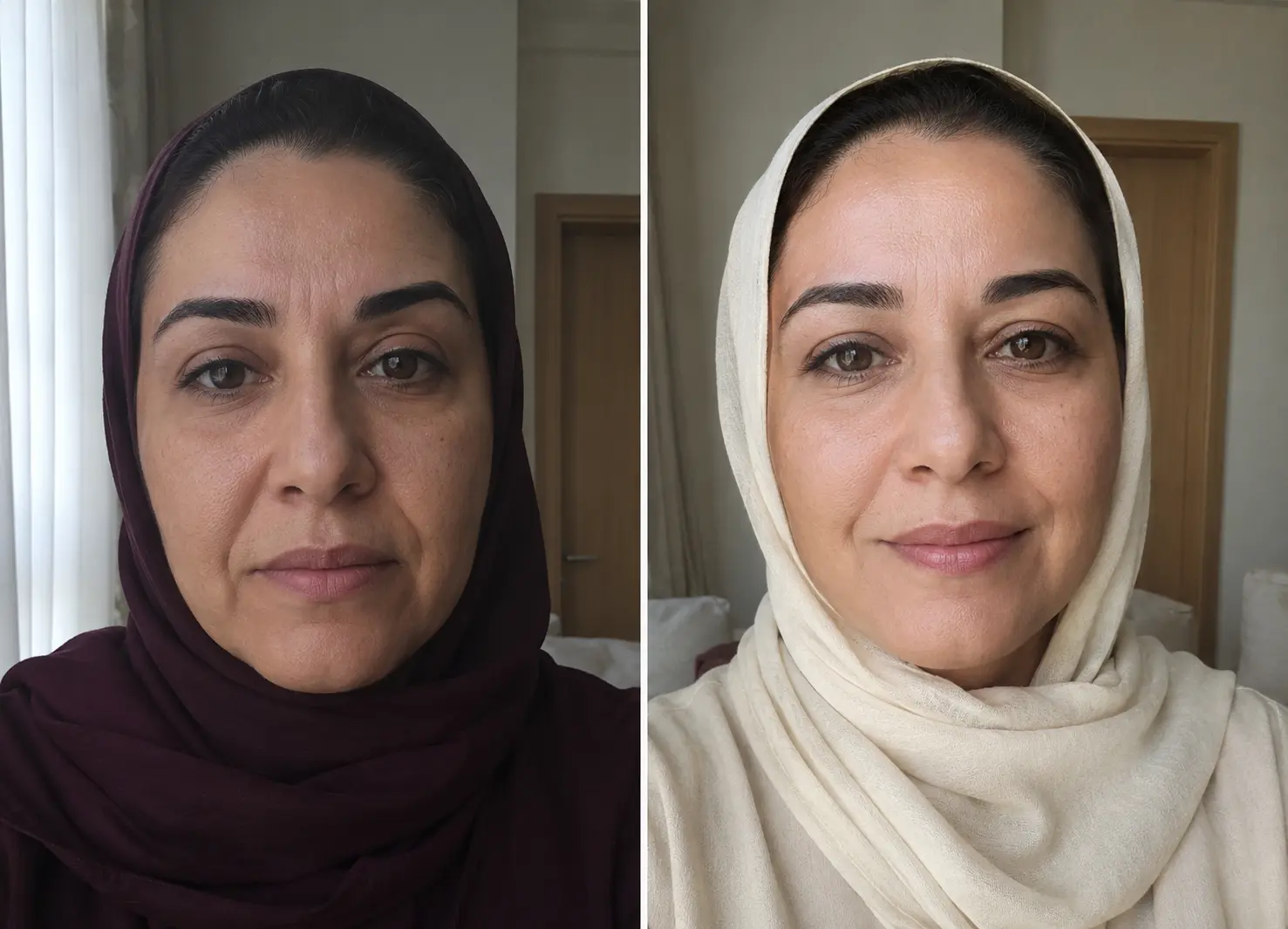 تجربة فاطمة الحربي مع علكات التجاعيد
