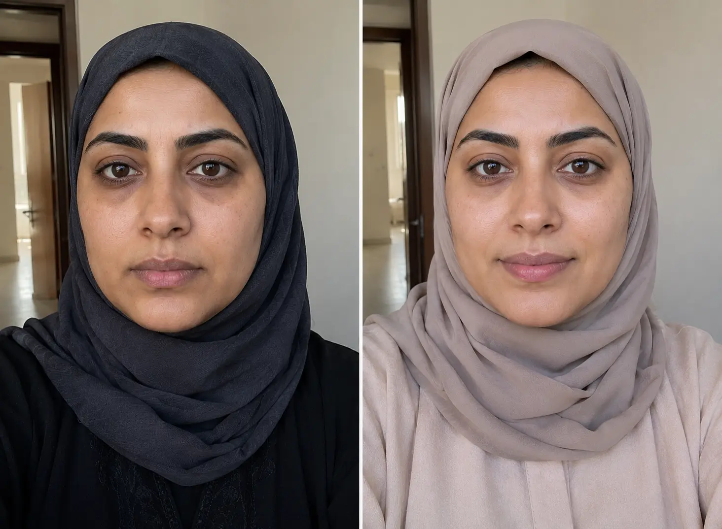 تجربة العنود الدوسري مع علكات النضارة