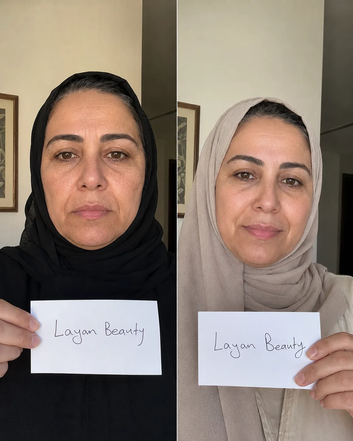 هند الشهري — تجربة مع علكات الكولاجين والترميلا
